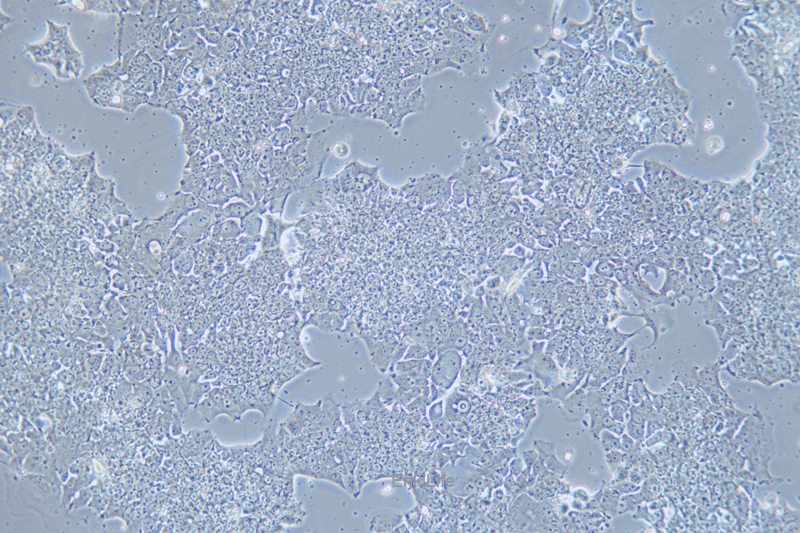 人肺癌细胞NCI-H2170