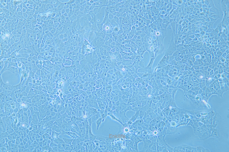 人肺癌细胞NCI-H2228