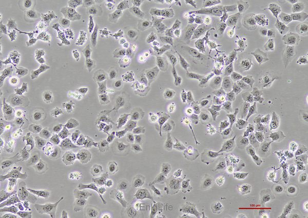人肺癌细胞NCI-H23 [H23]