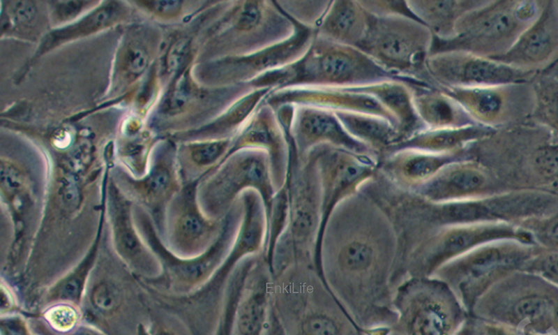 人肺腺癌细胞NCI-H3255