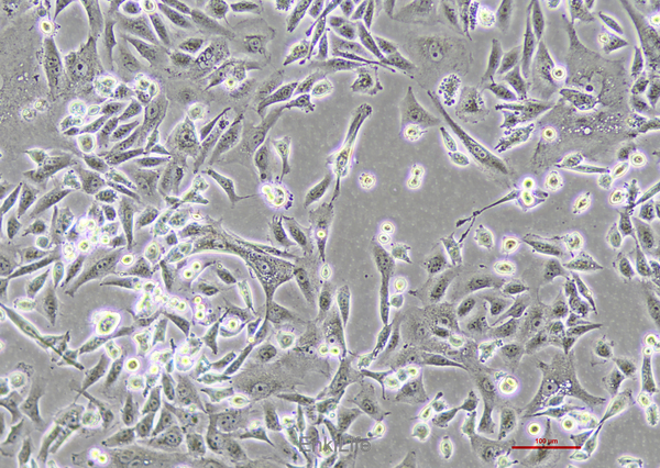 人肝癌细胞sk-hep-1