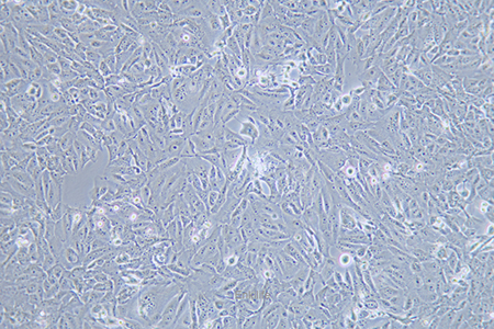 人骨肉瘤细胞143B