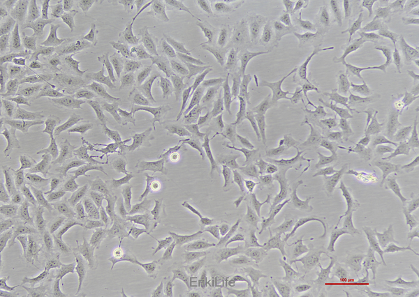 人骨肉瘤细胞HOS