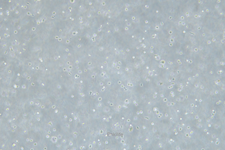 人骨髓瘤细胞U266