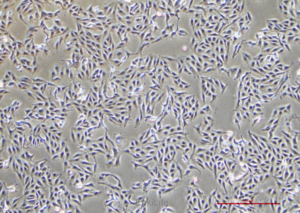 人黑色素瘤细胞A875