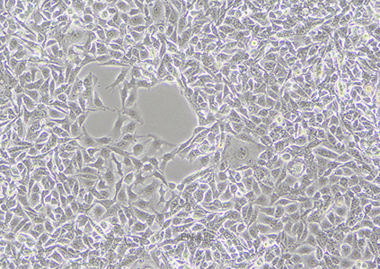 人黑色素瘤细胞MNT-1