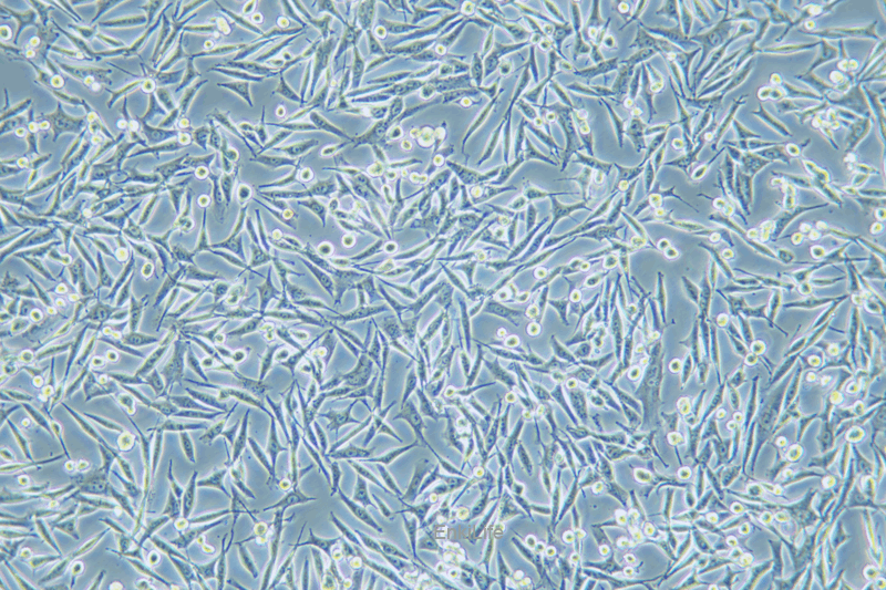 人黑素瘤细胞WM-115
