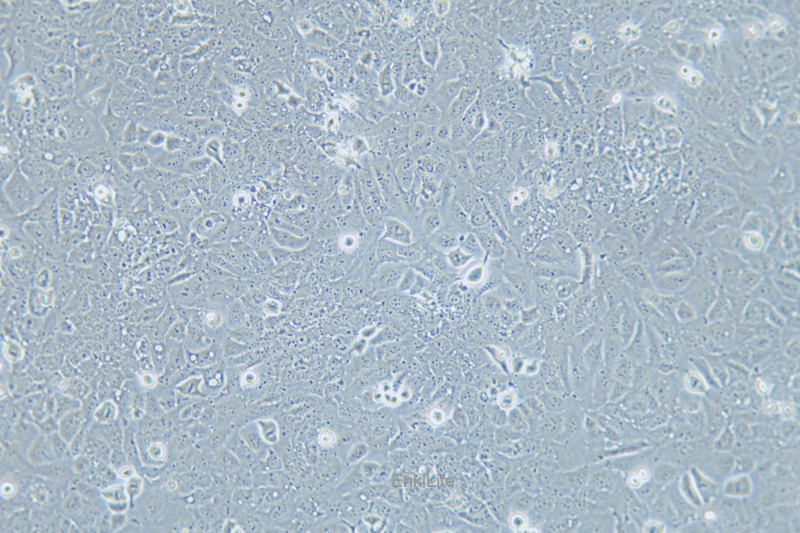 人喉癌细胞TU138