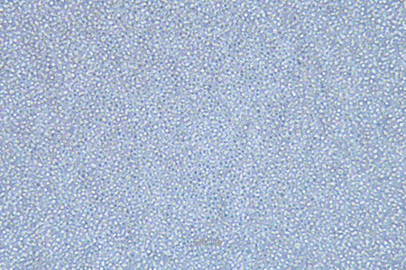 人急性髓性白血病细胞KG-1A