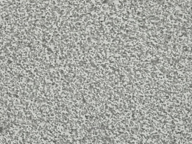 人间变性大细胞淋巴瘤细胞Karpas-299