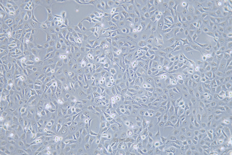 人角膜上皮细胞HCE-T