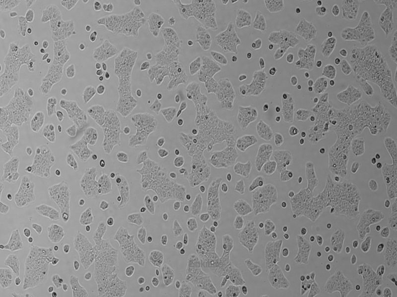 人结肠腺癌细胞SW1116