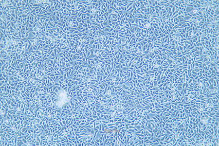 人结直肠癌细胞P53R