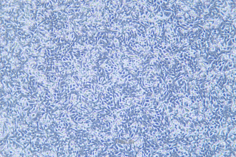 人结直肠腺癌细胞荧光素酶标记SW620-LUC