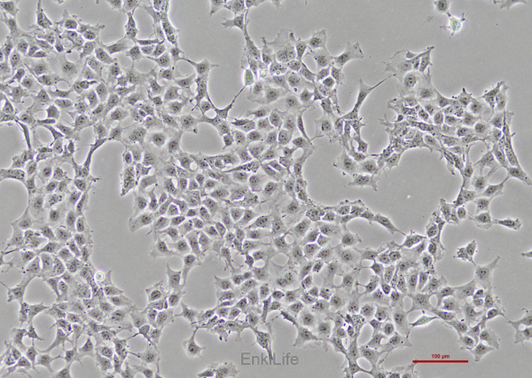 人卵巢畸胎瘤细胞PA-1