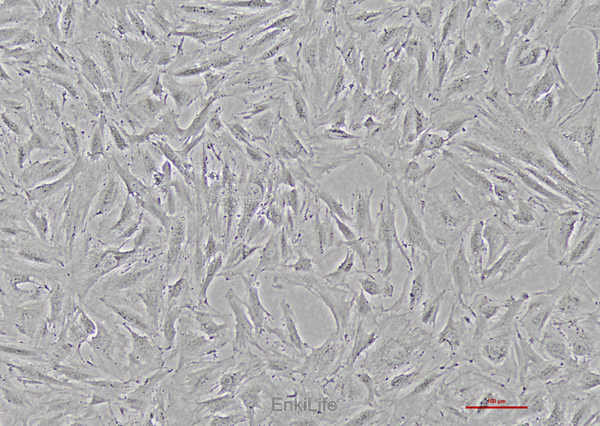 人卵巢颗粒细胞瘤细胞KGN