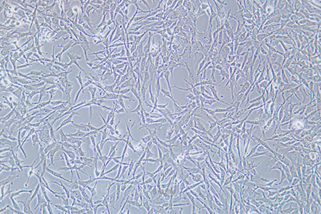 人卵巢透明细胞癌细胞ES-2