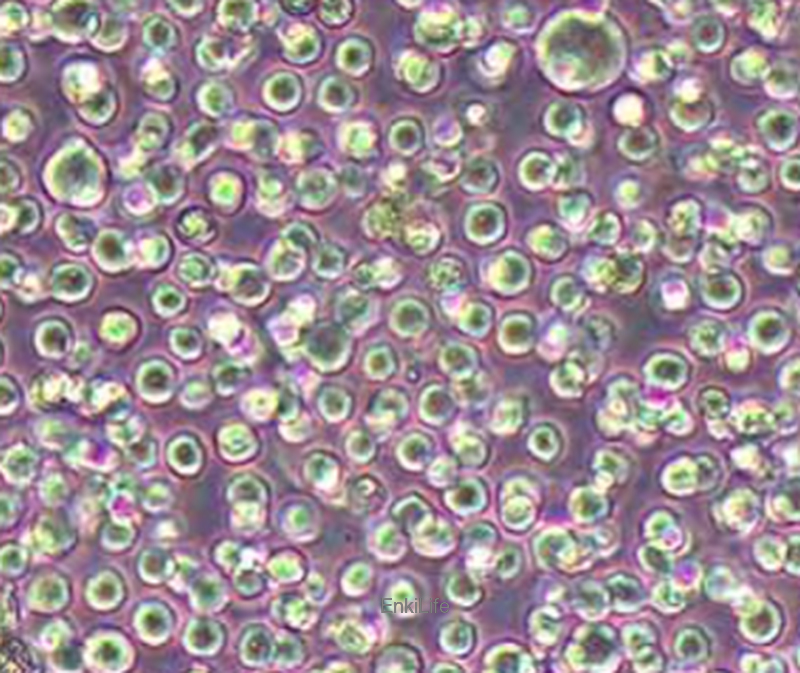 人弥漫大B淋巴瘤细胞HBL-1