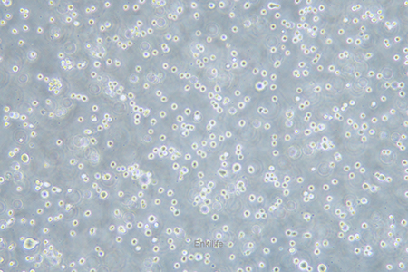 人弥漫性大B细胞淋巴瘤细胞DB