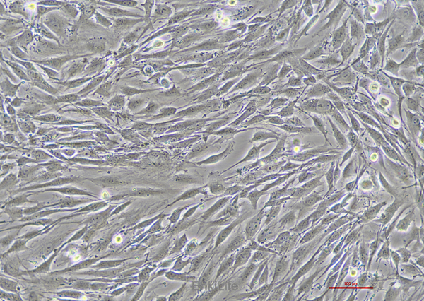 人脑星形胶质母细胞瘤U-118 MG