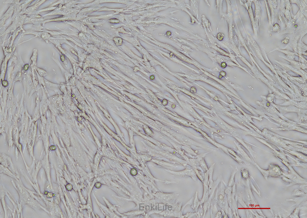 人胚肺成纤维细胞HFL-1