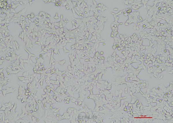 人前列腺癌细胞22RV1