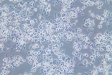 人乳腺癌细胞AU565