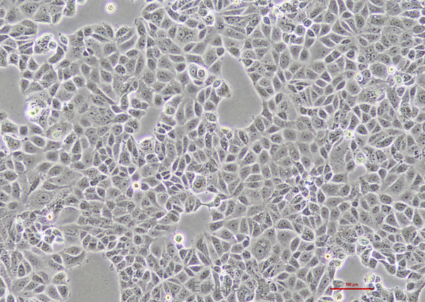 人乳腺癌细胞MCF-7