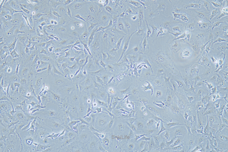 人乳腺癌细胞MDA-MB-157