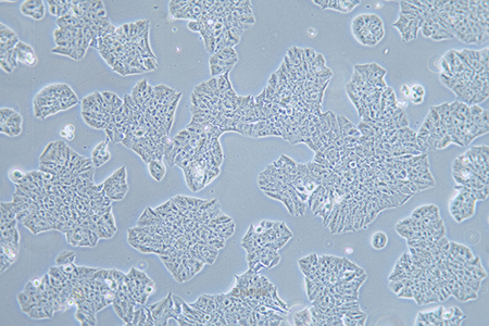 人乳腺癌细胞MDA-MB-361