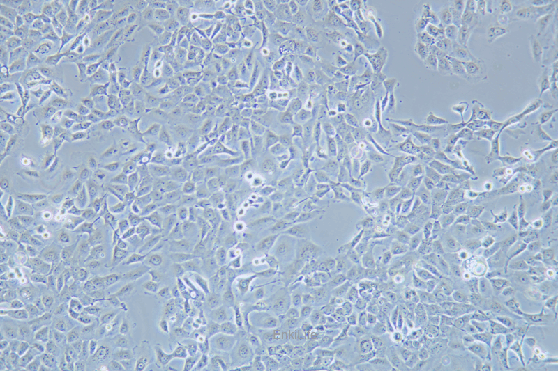 人乳腺癌细胞SUM149PT