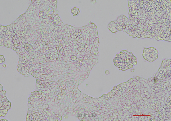 人乳腺导管瘤细胞UACC-812