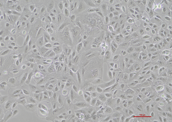 人肾癌细胞OS-RC-2
