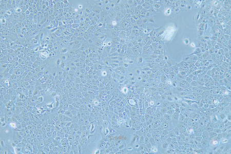 人食管癌细胞Eca-109
