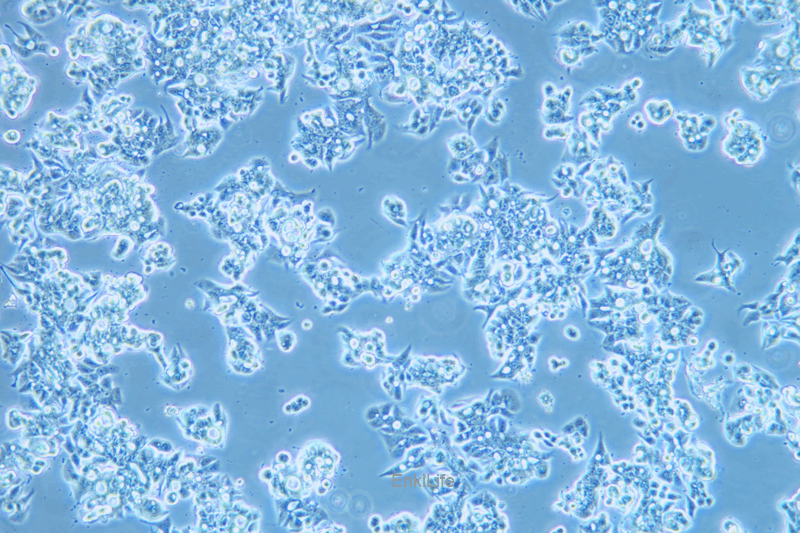 人食管癌细胞OE19
