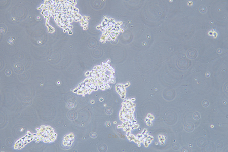 人视网膜神经胶质瘤细胞WERI-RB-1