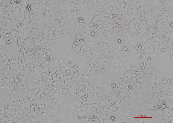 人咽鳞癌细胞FaDu