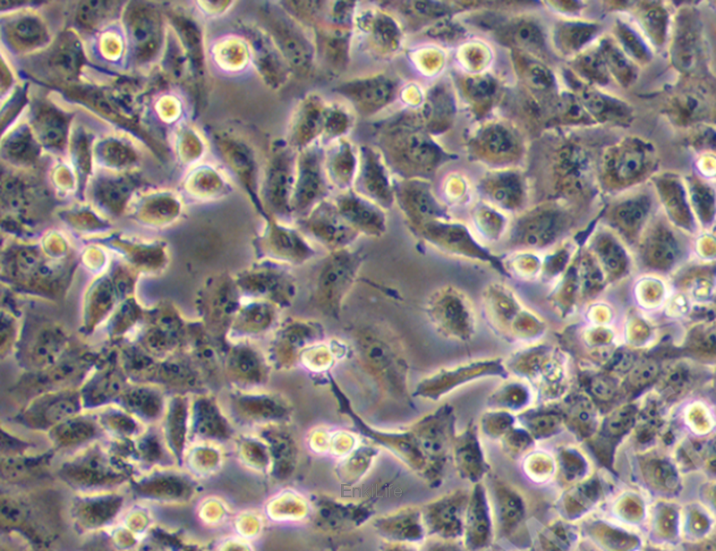 人胰腺癌细胞 PATU8988S