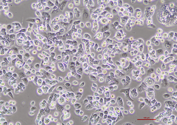 人胰腺癌细胞Capan-1
