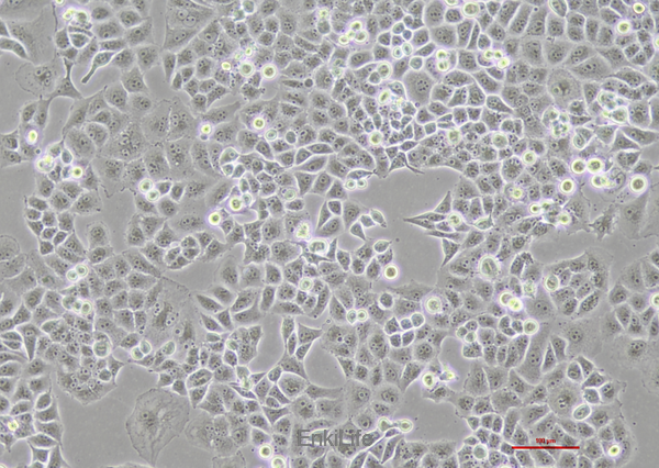 人胰腺癌细胞荧光素酶稳转株PANC-1-LUC
