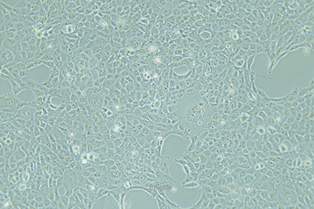 人整合SV40基因的乳腺上皮细胞HBL-100
