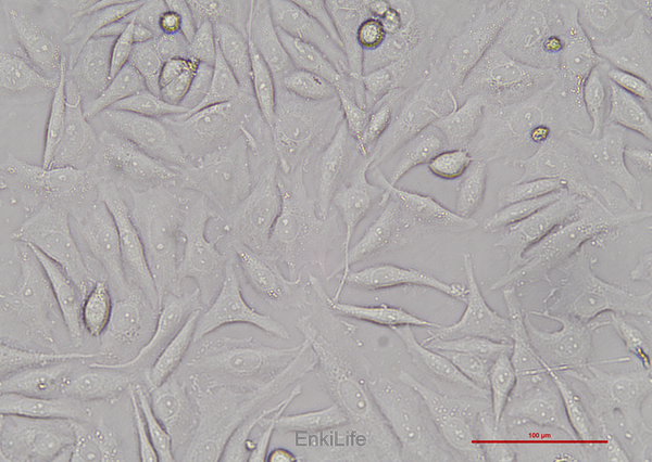 人子宫颈鳞癌细胞SiHa