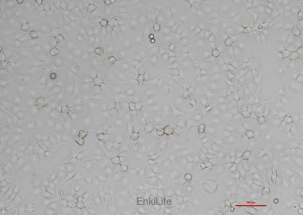 人子宫颈上皮细胞永生化