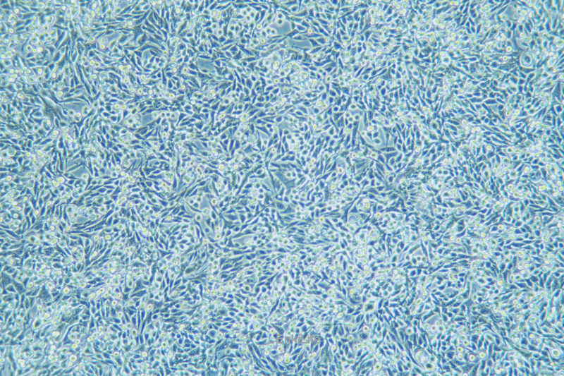 小鼠膀胱癌细胞稳定表达荧光素酶MB49+LUC