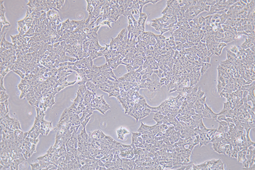 小鼠垂体瘤细胞GT1-1