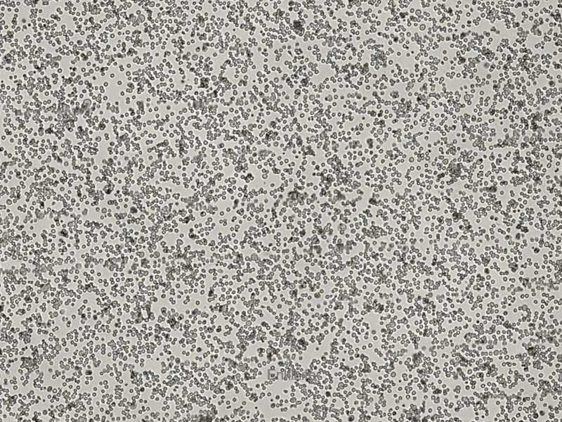 小鼠急性骨髓性白血病细胞C1498