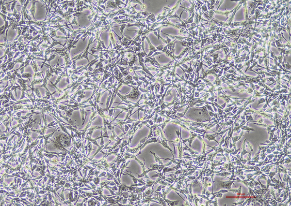 小鼠结肠癌细胞CT26.CL25