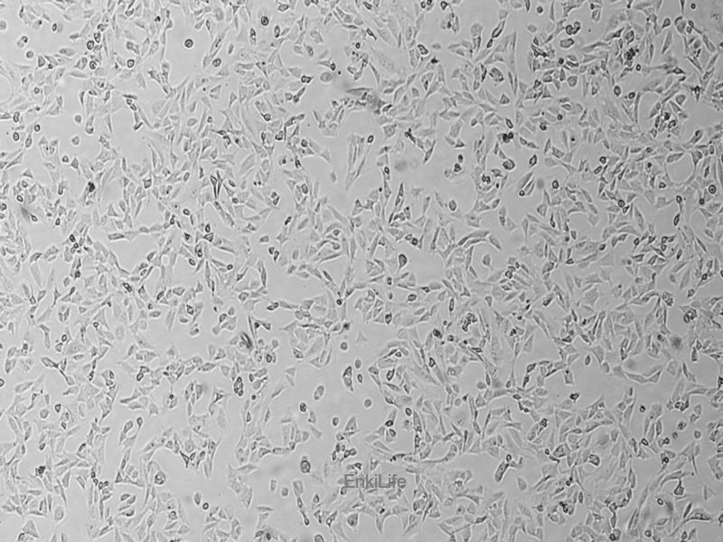 小鼠胚胎成纤维细胞BALB/3T3 clone A31