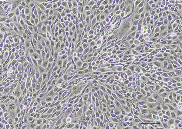 小鼠胰岛内皮细胞MS-1