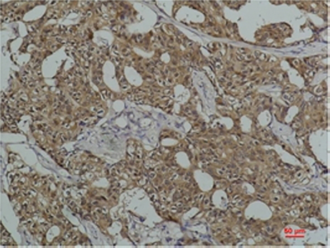Hsc70 (5C2)鼠单抗,Hsc70 (5C2) Mouse Monoclonal Antibody